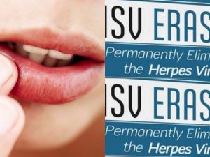 Herpes Erased Review